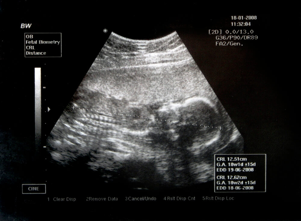 Application of Ultrasound Imaging in Modern Medicine explained by PostDICOM